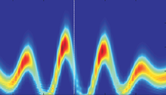 Atto- and femtosecond metrology